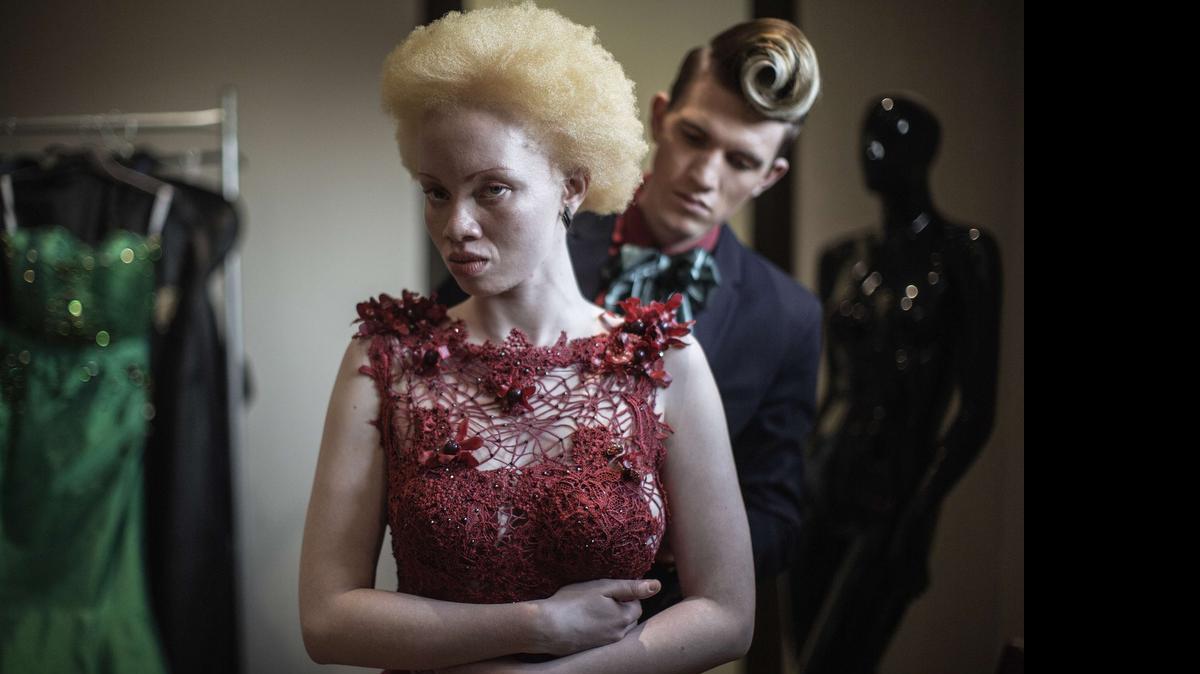 
La modelo albina, Thando Hopa.
