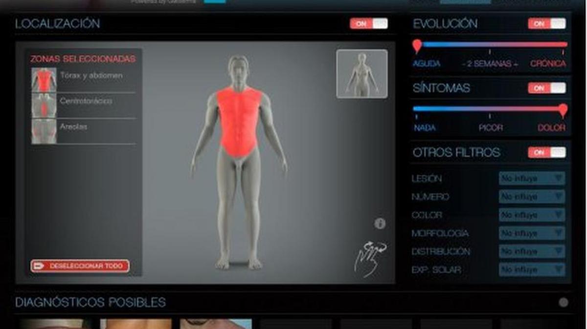 Esta app, dirigida a profesionales, ayuda a diagnosticar y a detectar enfermedades de la piel, entre ellas alergias e hinchazones.
