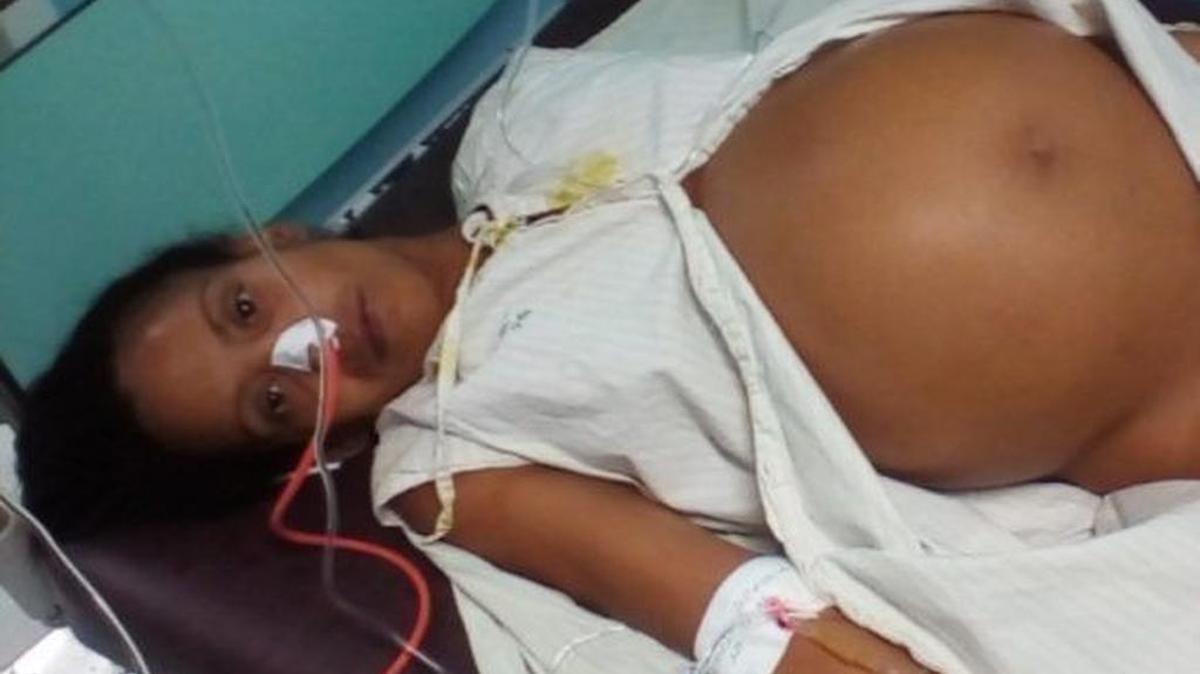 Aliuska Elizástigui Masó tenía 22 semanas de embarazo pero con el fibroma el tamaño del vientre parecía el de una mujer a punto de dar a luz.