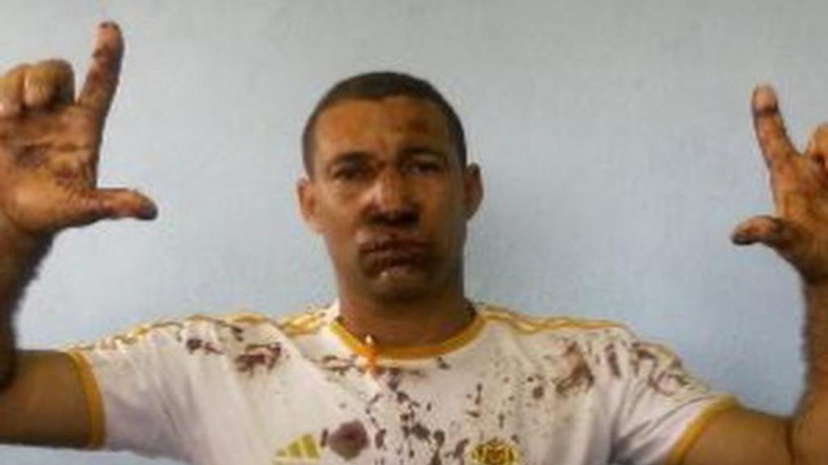 
El activista Yriade Hernández Aguilera después de su liberación. 
