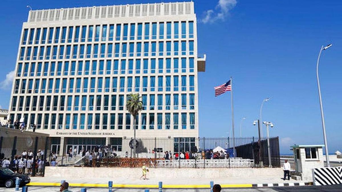 El Departamento de Estado pudiera retirar personal de su embajada en La Habana para protegerlos de los “ataques sónicos” que han sufrido m,uchos diplomáticos.