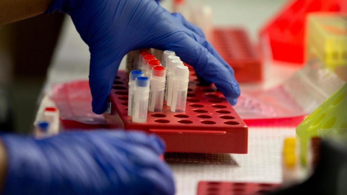 El “Heberferon” es una novedad científica obtenida por el Centro de Ingeniería Genética y Biotecnología (CIGB) de La Habana tras más de 20 años de investigaciones.