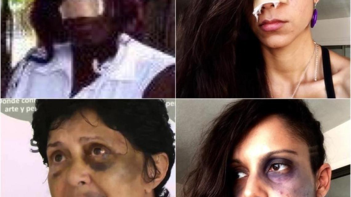 En las redes sociales activistas usaron Halloween para denunciar la represión contra los opositores. Los participantes subieron imágenes recreando con máscaras y maquillaje a las víctimas de los actos represivos.