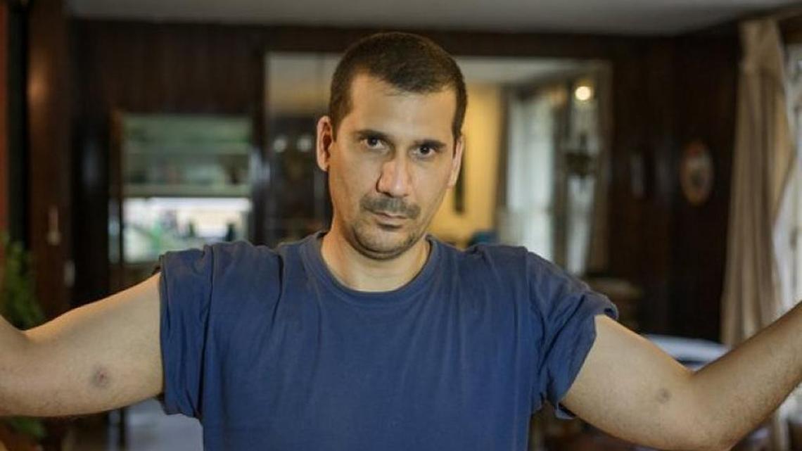 El activista cubano Antonio Rodiles muestra las huellas de los pinchazos en su cuenta de Twitter.