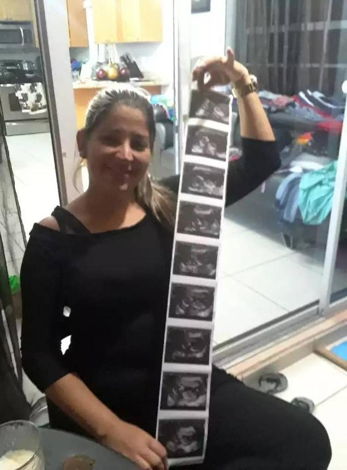 Yarisleidy Cuba Rodríguez muestra las imágenes del ultrasonido de su embarazo.