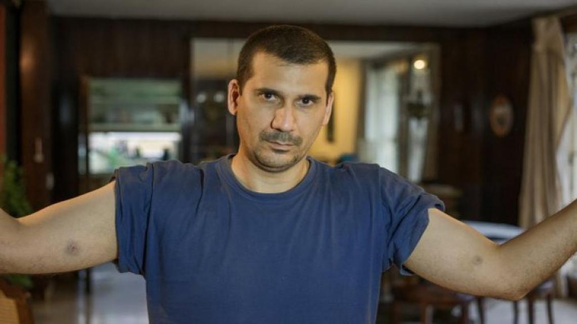 El activista cubano Antonio Rodiles muestra las huellas de los pinchazos en su cuenta de Twitter.