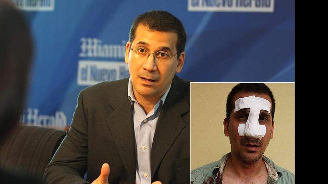 Rodiles, conocido activista por los derechos humanos, impulsor de proyectos cívicos como Estado de Sats y el Foro por los Derechos y las Libertades tuvo que ser hospitalizado y someterse a una cirugía en el hospital Calixto García, tras recibir un fuerte puñetazo en la nariz que le ocasionó una fractura.