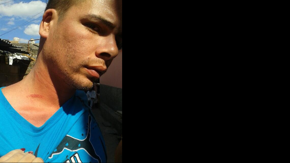 
Daril Ferrer, hijo mayor del prominente disidente cubano Darsi Ferrer, que ahora vive en Miami, fue detenido violentamente el viernes por la policía en Pinar del Rio.
