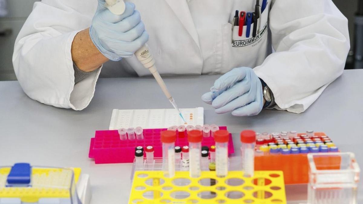 Un empleado de laboratorio examina una muestra de anticuerpos en un laboratorio de la compañía Euroimmun en Dassow (Alemania) hoy, 5 de febrero de 2016.