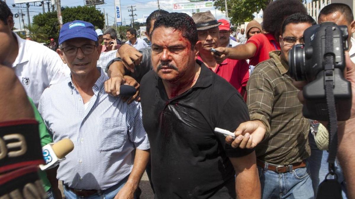 Augusto Valle (cen.), diputado del Partido Liberal Independiente (PLI), camina luego de ser herido durante una protesta en Managua el miércoles.