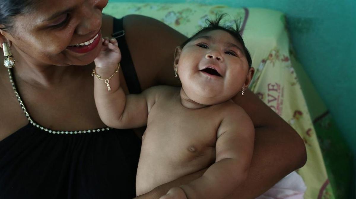 María da Luz Mendes Santos con su hija Heloyse, quien nació con microcefalia.