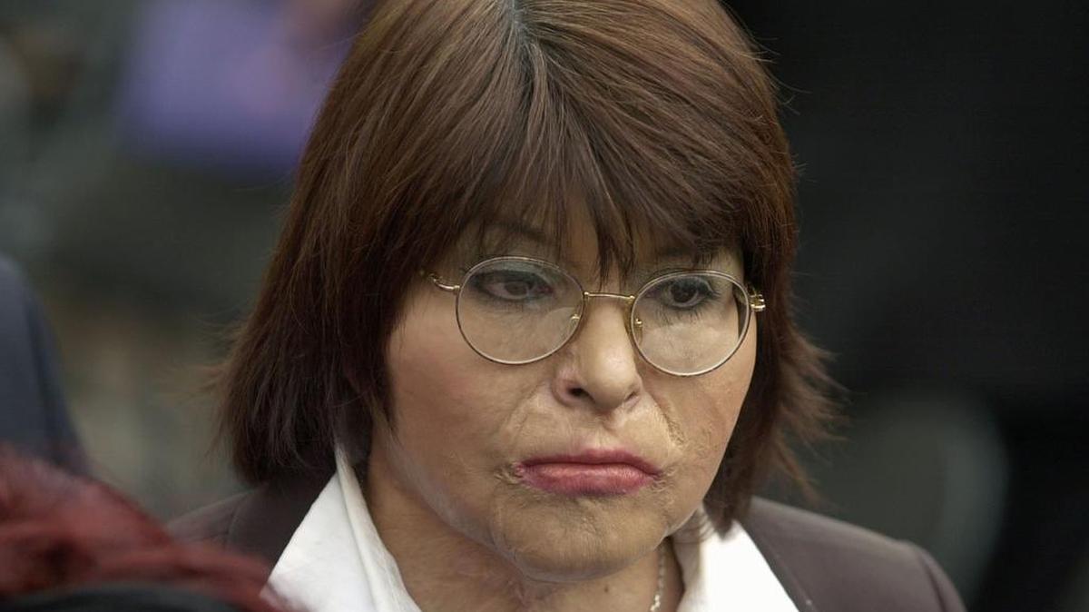 
La chilena Carmen Gloria Quintana atiende una ceremonia en julio de conmemoración del golpe de Estado de Augusto Pinochet, en Santiago de Chile. Quintana fue rociada con gasolina y quemada viva por ex reclutas. 
