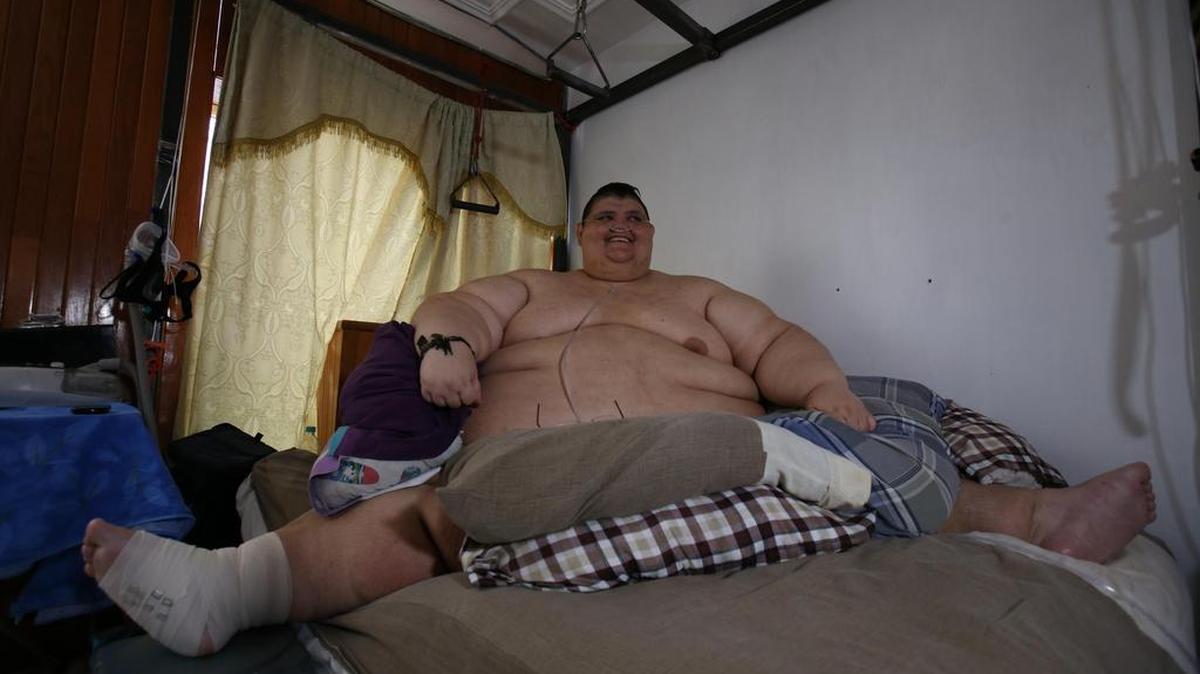 El mexicano Juan Pedro, quien con 595 kilos llegó a ser el hombre más obeso del mundo, el martes 28 de marzo de 2017 en la ciudad mexicana de Guadalajara, donde sus médicos informaron que está preparado para entrar al quirófano el próximo 9 de mayo luego de perder casi 30 por ciento de su peso corporal.