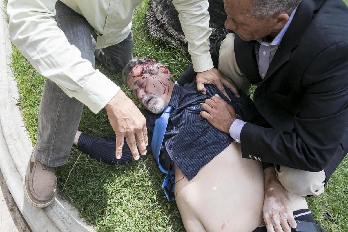 El diputado Américo De Grazia es auxiliado tras ser golpeado por manifestantes chavistas que ingresaron a la Asamblea Nacional el miércoles 5 de julio de 2017, en Caracas (Venezuela).