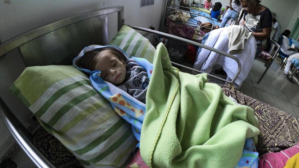 Un bebé desnutrido permanece en una cama de hospital en Maracay, estado de Aragua, Venezuela, el 7 de febrero de 2019.