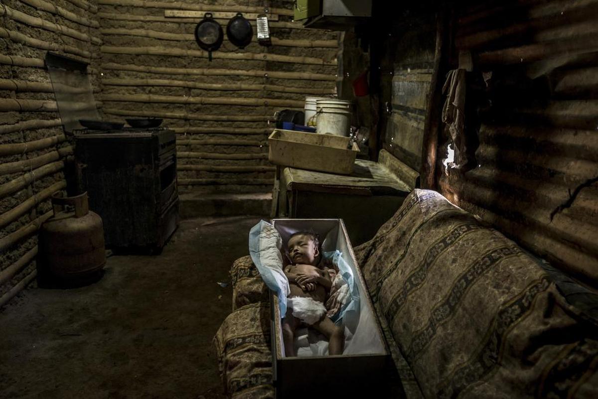 El niño Kenyerber Aquino Merchán, de 17 meses, falleció por problemas cardiacos causados por la desnutrición, en San Casimiro, Venezuela. El hambre ha acechado a Venezuela durante años. Pero ahora, según médicos en los hospitales públicos, está cobrando una cantidad alarmante de vidas de menores de edad.