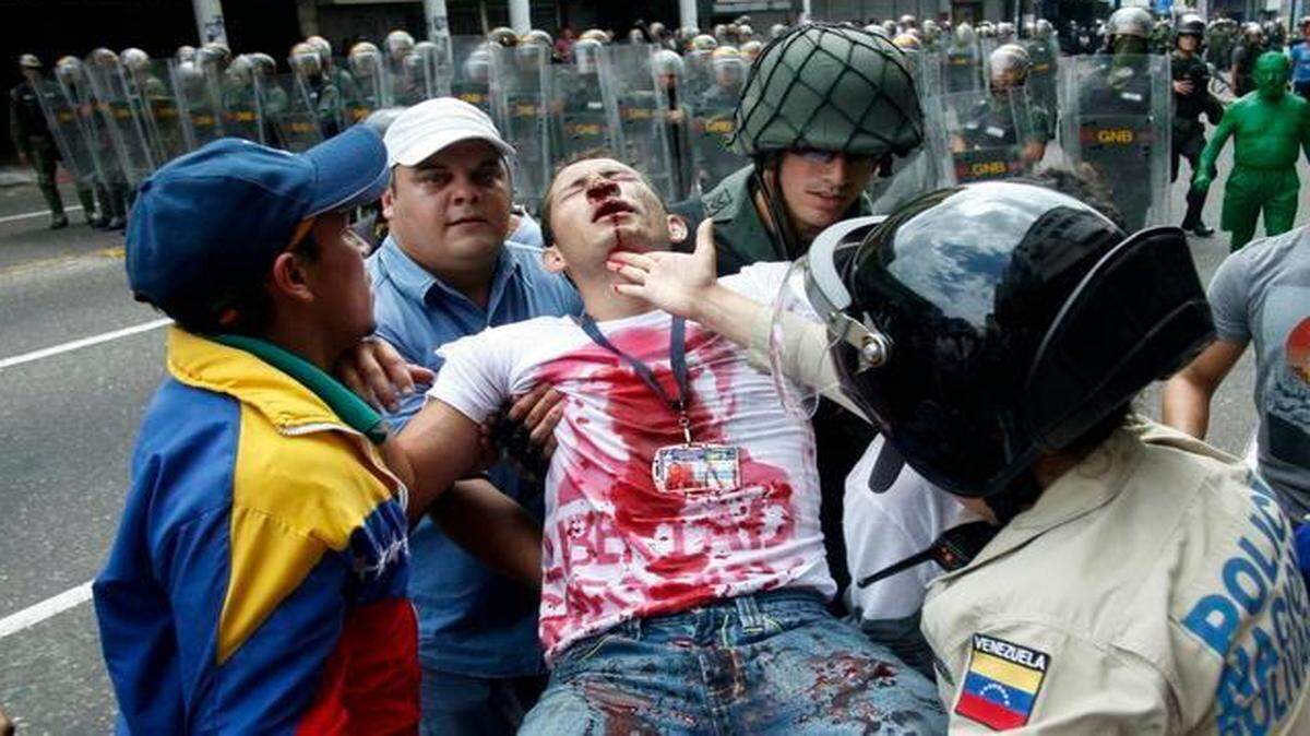 
Un joven estudiante es cargado después de resultar herido durante una protesta contra el gobierno de Nicolás Maduro en la ciudad venezolana de San Cristóbal.
