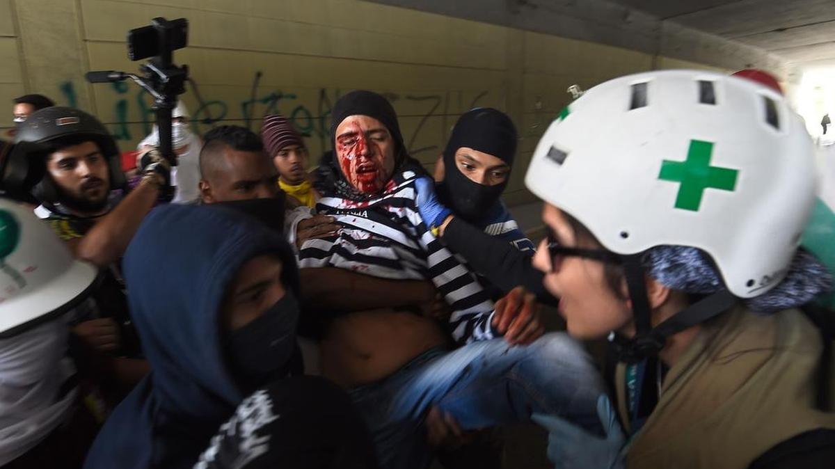 Un manifestante herido es ayudado por sus compañeros el lunes en Caracas, Venezuela.