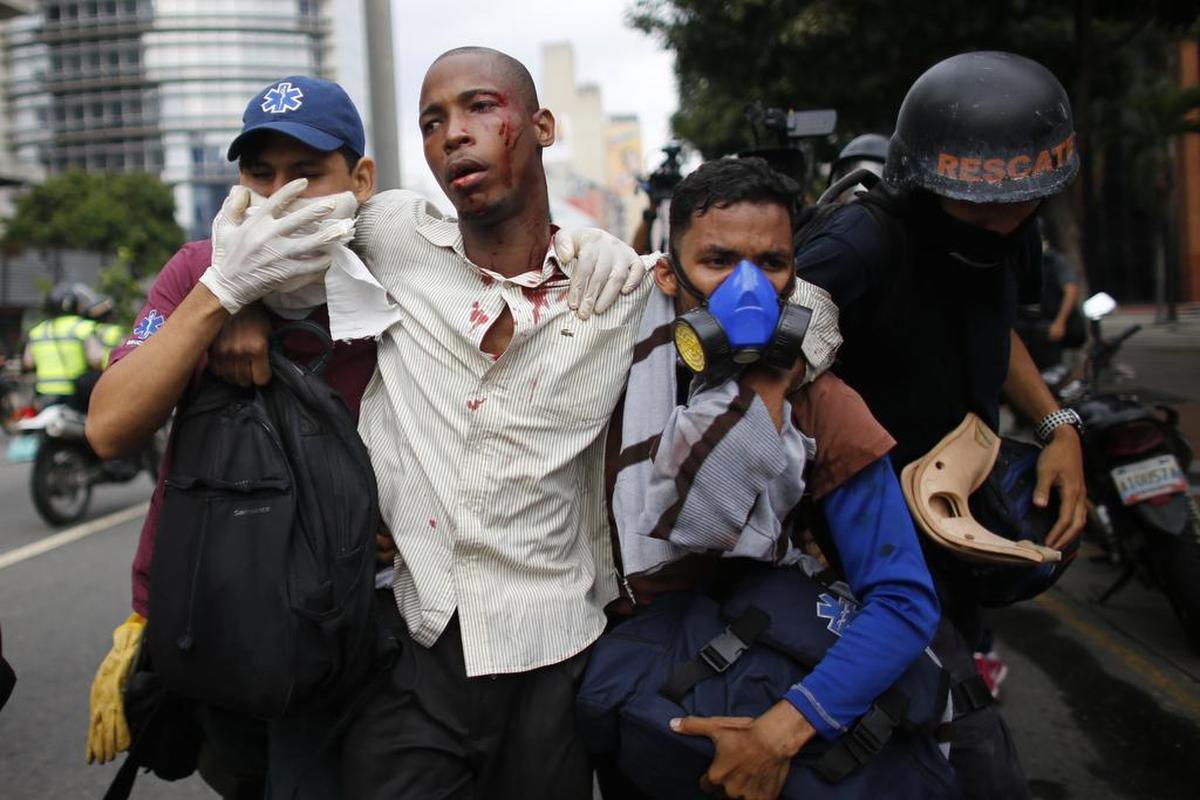 Los paramédicos ayudan a un hombre herido durante los enfrentamientos con las fuerzas de seguridad durante las protestas que piden la renuncia del presidente Nicolás Maduro en Caracas, Venezuela, el jueves 20 de abril.