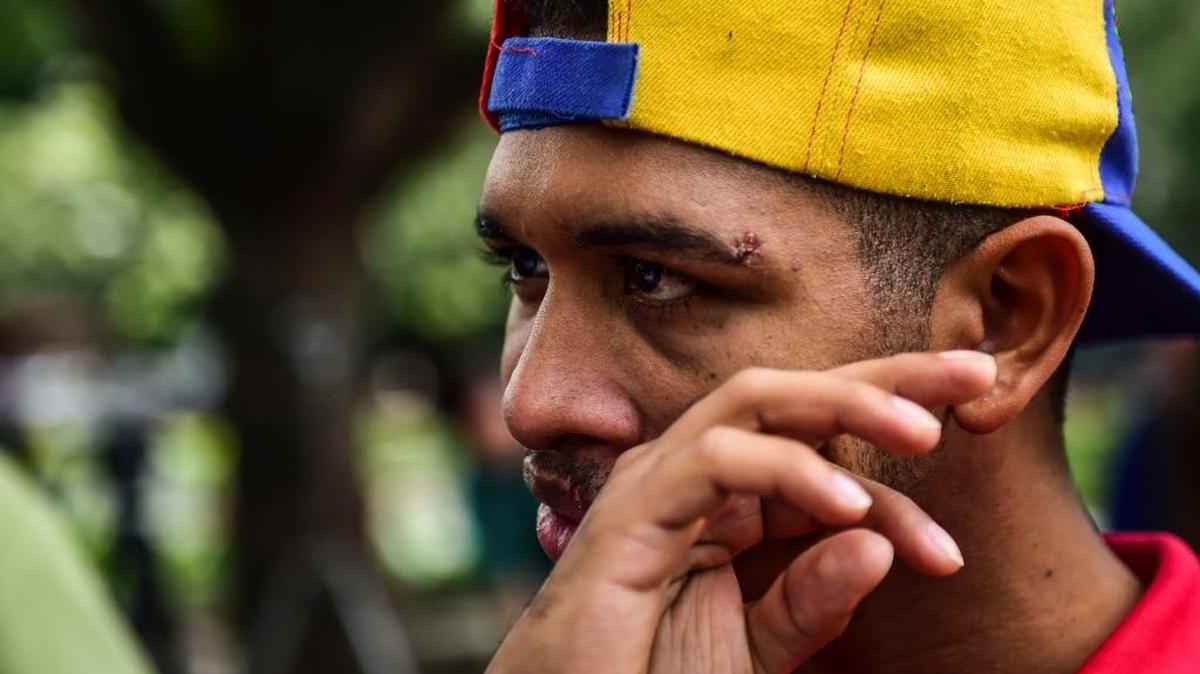 El músico y opositor venezolano Wuilly Arteaga en una conferencia de prensa en la plaza de Altamira en Caracas, el 17 de agosto. El gobierno le prohibió participar en protestas.