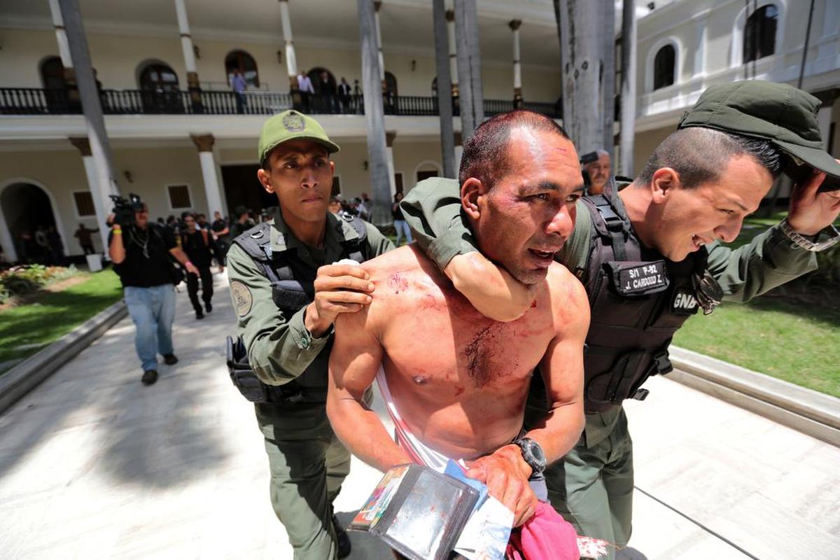 Un simpatizante del Gobierno, que resultó herido, es retirado de la Asamblea Nacional el miércoles 5 de julio de 2017, en Caracas (Venezuela).