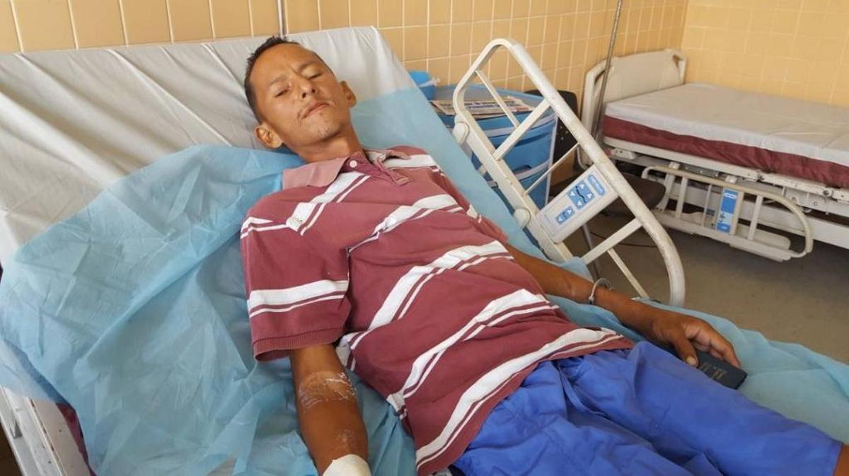 Alejandro Manuel Mago Coraspe, de 41 años, fue operado esta semana tras haber comido ratas que encontró muertas en el basurero de la cárcel Vista Hermosa, en el estado Bolívar.