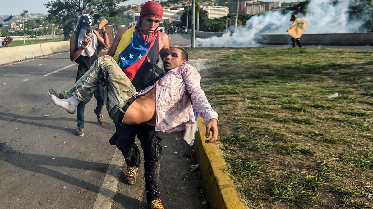 Un joven herido es ayudado por un compañero durante los enfrentamientos entre opositores y la fuerzas policiales el 31 de mayo de 2017 en Caracas, Venezuela.