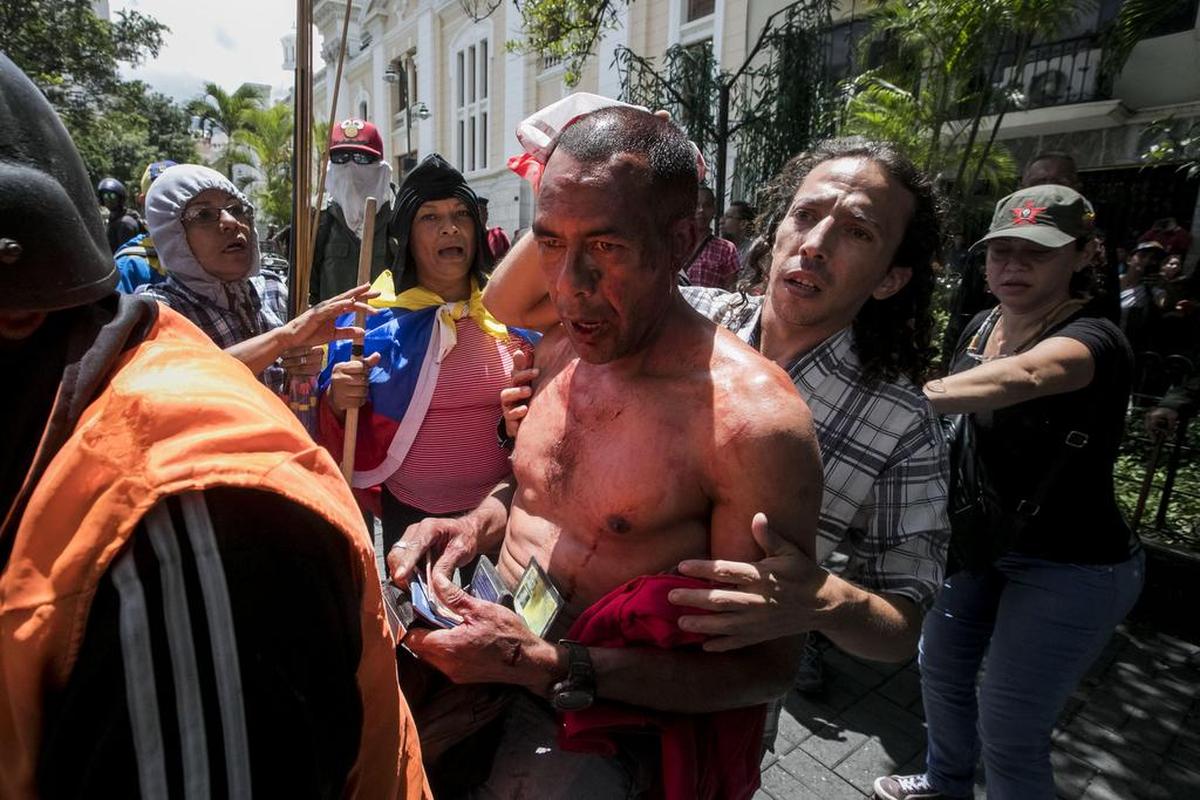 Un simpatizante del Gobierno, que resultó herido, es retirado de la Asamblea Nacional el miércoles 5 de julio de 2017, en Caracas (Venezuela).
