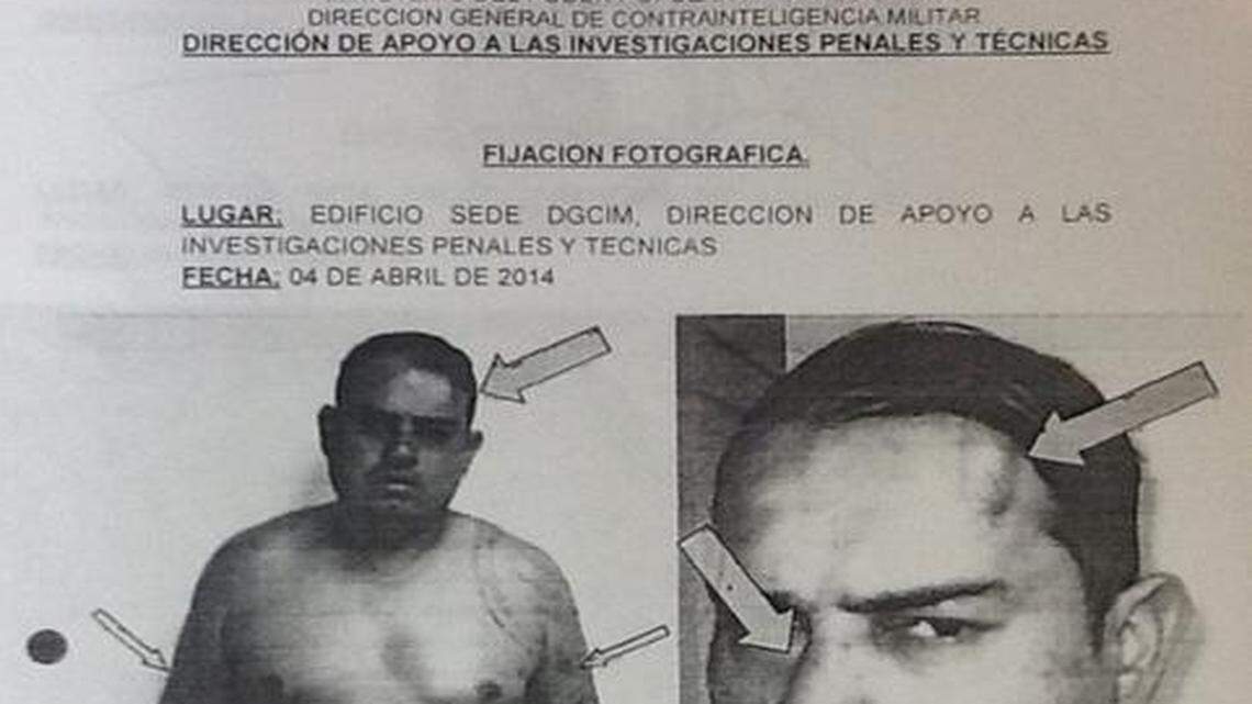 
Informe de la Dirección General de Contrainteligencia Militar que documenta las lesiones que sufrió el capitán Juan Carlos Nieto.
