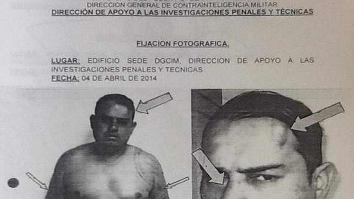
Informe de la Dirección General de Contrainteligencia Militar que documenta las lesiones que sufrió el capitán Juan Carlos Nieto.

