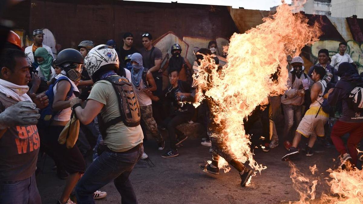 Un hombre fue quemado durante una protesta en Caracas el 20 de mayo de 2017.