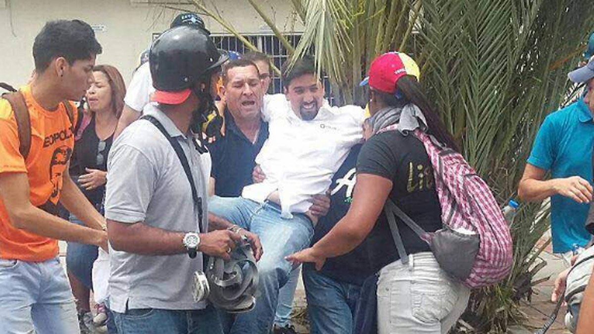 El primer vicepresidente de la Asamblea Nacional, el diputado Freddy Guevara, resultó herido este miércoles, durante las acciones de protesta contra el Gobierno de Nicolás Maduro, que tienen lugar en Caracas. Imagen compartida en Twitter.