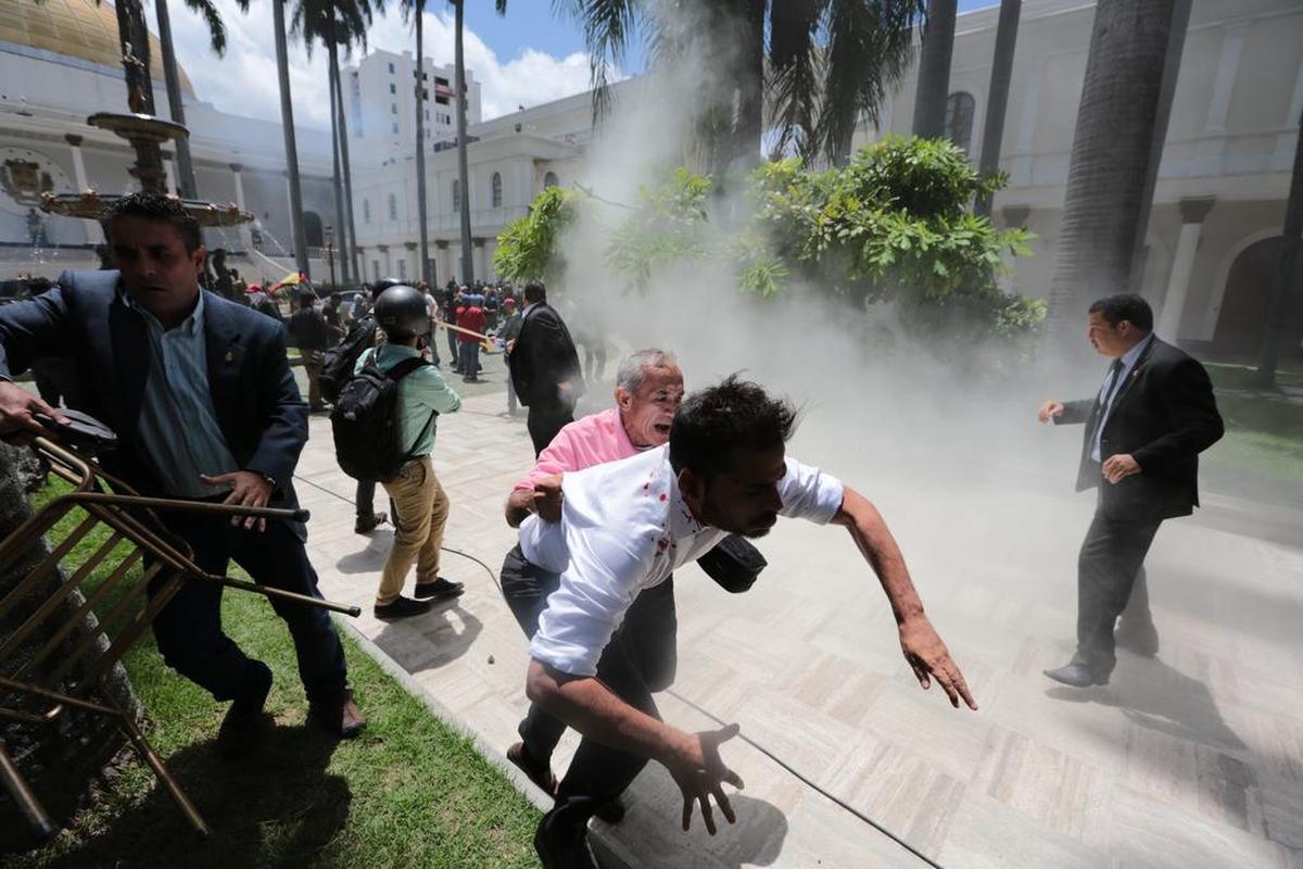El diputado Armando Armas es escoltado con la camisa llena de manchas de sangre luego de ser atacado por colectivos armados chavistas en Caracas, el 5 de julio de 2017. En la foto, se ve a la derecha al diputado Silmon Calzadilla.