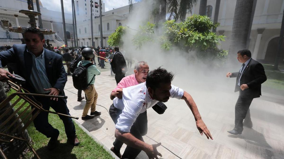 El diputado Armando Armas es escoltado con la camisa llena de manchas de sangre luego de ser atacado por colectivos armados chavistas en Caracas, el 5 de julio de 2017. En la foto, se ve a la derecha al diputado Silmon Calzadilla.