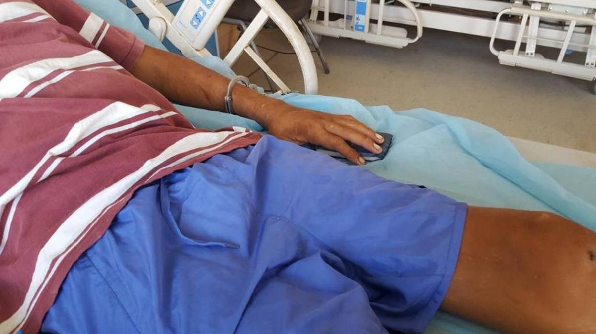 Alejandro Manuel Mago Coraspe, de 41 años, fue operado esta semana tras haber comido ratas que encontró muertas en el basurero de la cárcel Vista Hermosa, en el estado Bolívar.