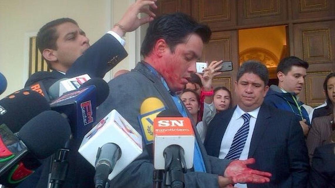 Foto compartida por José Correa, un militante de Primero Justicia, que muestra al diputado opositor Carlos Paparoni después de ser agredido por chavistas, el jueves en Caracas.