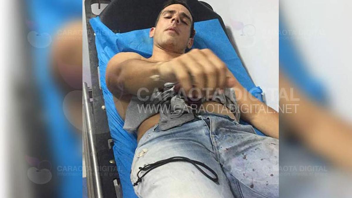El reportero venezolano Luis Olavarrieta fue agredido este domingo cuando cubría la consulta popular en el oeste de Caracas.