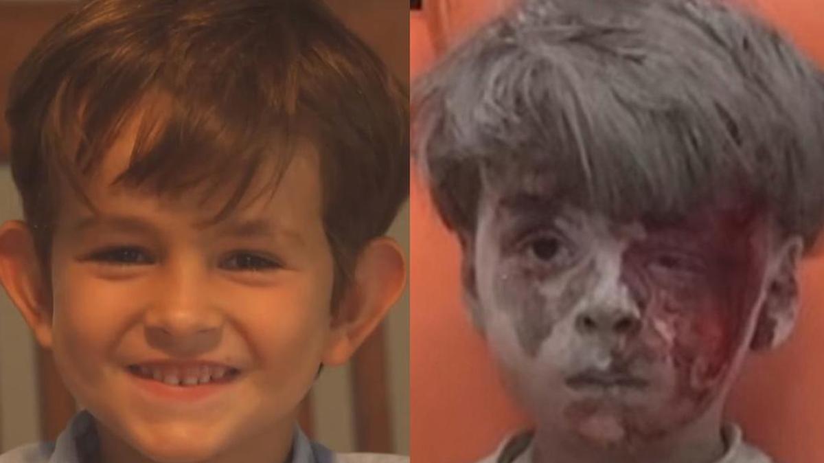 Alex (izquierda), el niño estadounidense que escribió a Obama y Omran Daqneesh, a la derecha, en la fotografía captada que dio vuelta al mundo.