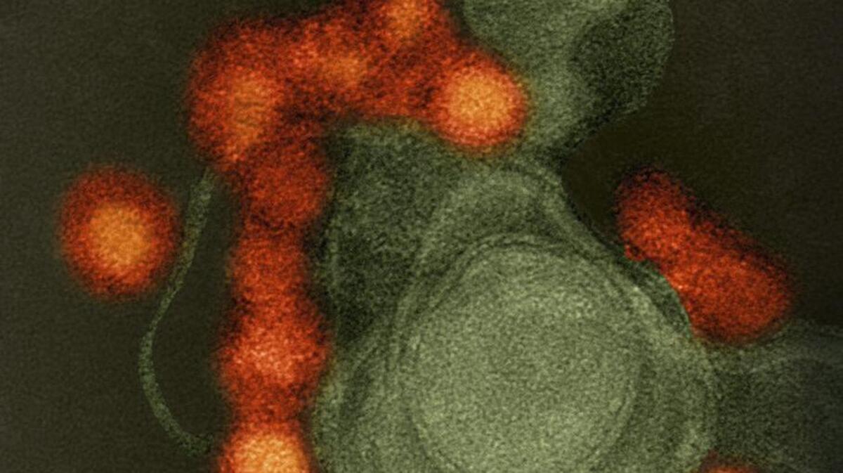 Una fotografía de archivo fechada el 19 de mayo de 2016 y facilitada por el Instituto Nacional de Alergias y Enfermedades Infecciosas (NIAID) el 4 de agosto de 2016, que muestra el virus zika (en rojo) extraído con un microscopio electrónico de un caso de microcefalia en Brasil.