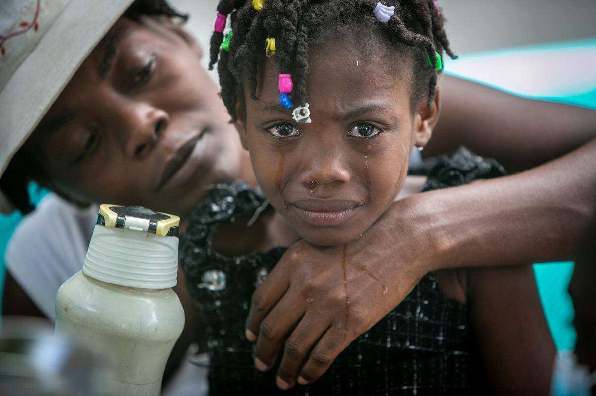 Les Cayes, Haití, 16 de agosto de 2021 - Una niña es consolada por su madre mientras las enfermeras atienden una herida en su pie en el hospital OFATMA. Los pacientes del hospital están siendo atendidos al aire libre. Aunque no se derrumbó, las paredes y los pisos del hospital se agrietaron durante el terremoto y nadie quiere volver a entrar.