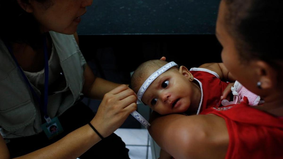 El Departamento de Salud de Nueva York informó de que cuatro niños más han nacido con problemas de salud vinculados al virus del Zika.
