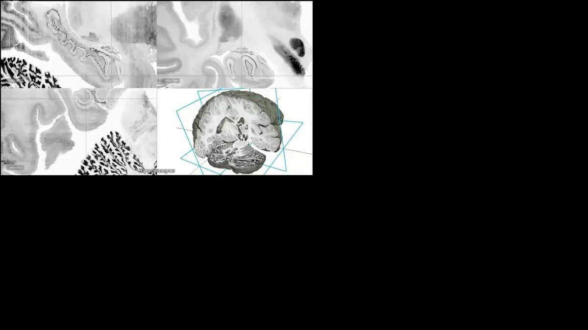 
Imagen proporcionada por los investigadores muestra en una forma muy detallada la región del hipocampo del cerebro humano.

