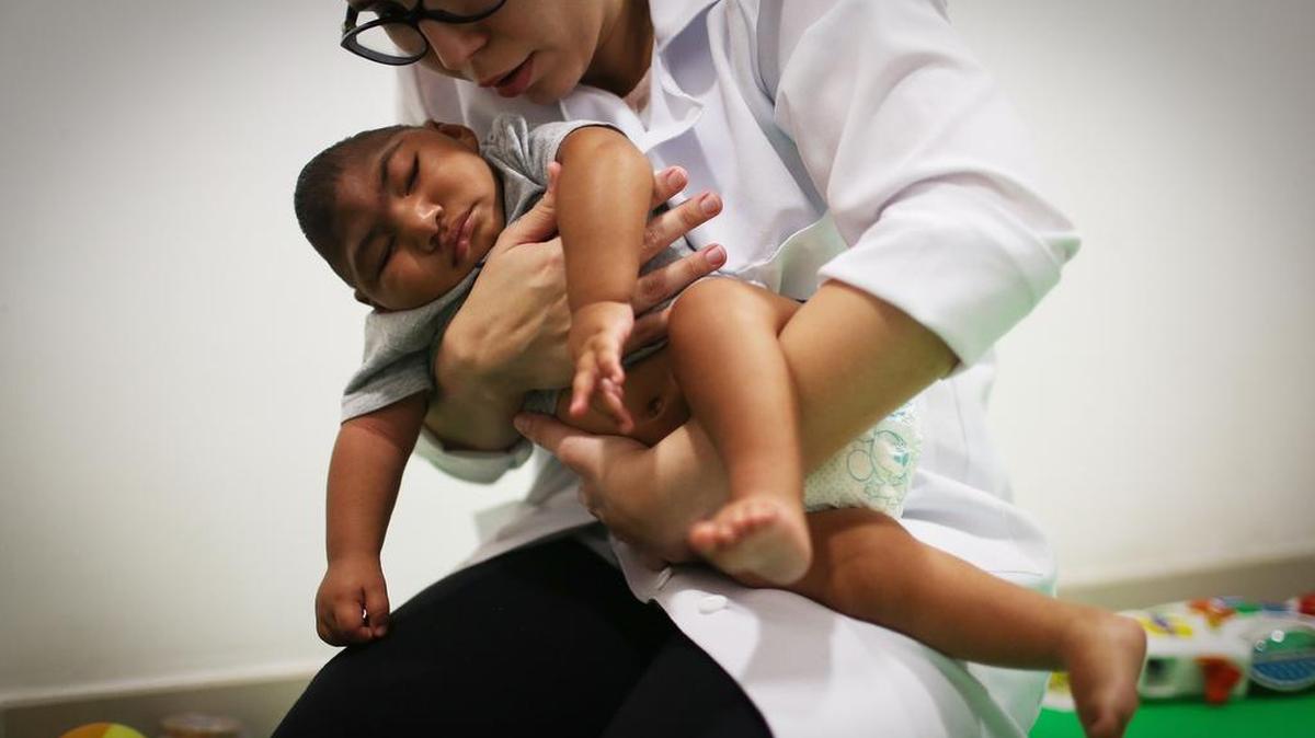 Un bebé con microcefalia en Recife, Brasil. El estado de Florida confirmó el martes el nacimiento del primer bebé con microcefalia.