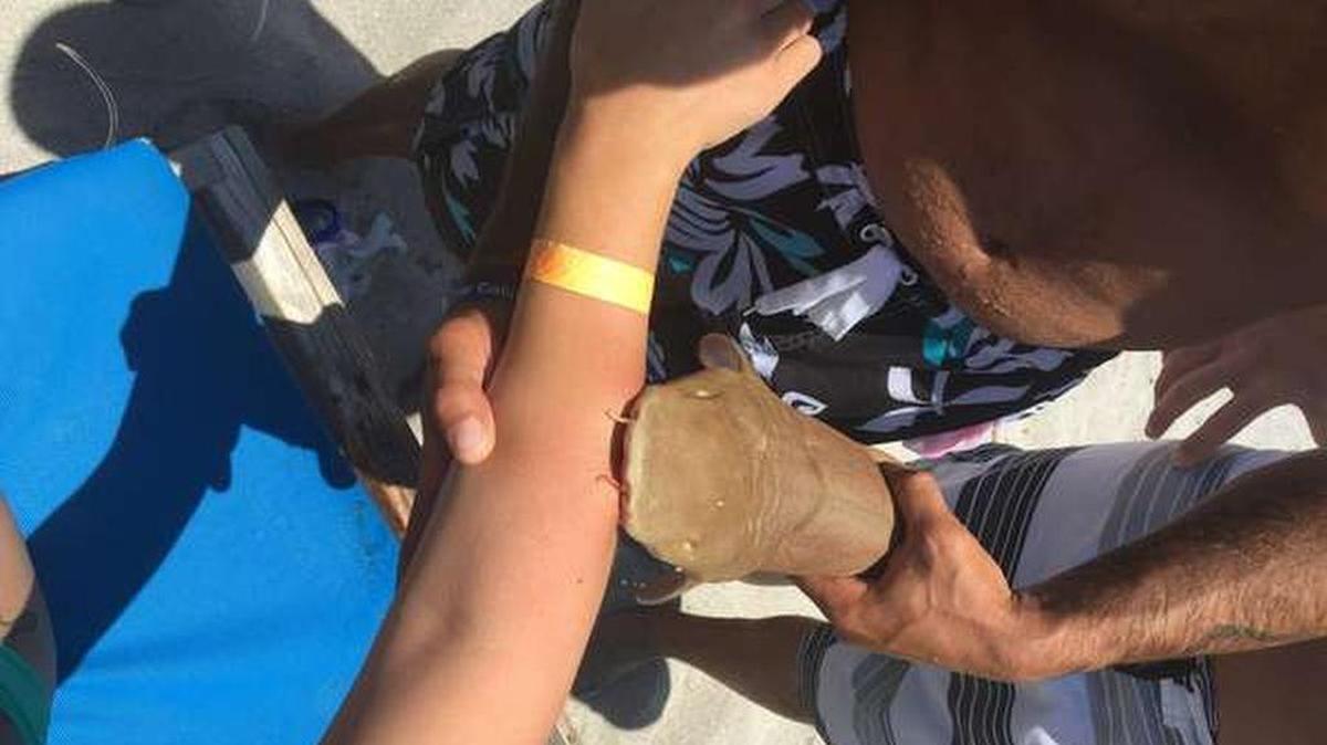 La jóven de 23 años muestra su brazo con el pequeño tiburon nodriza.