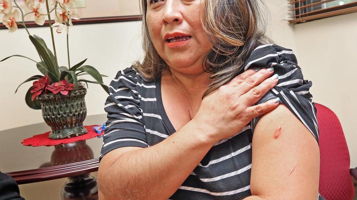 La hondureña Ingrid Banegas muestra las heridas de la violencia doméstica, durante un encuentro en las oficinas del CVAC el viernes pasado