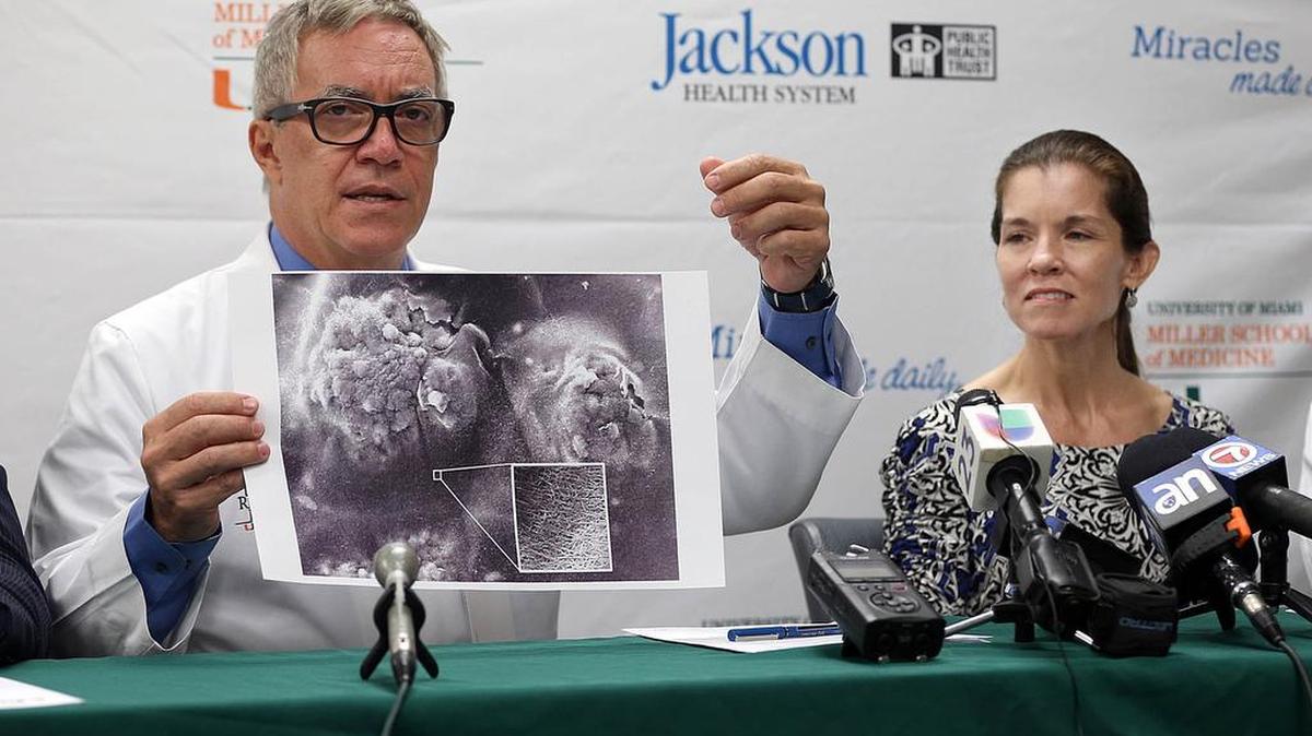 
El Doctor Camillo Riordi, director del Instituto de Investigaciones sobre la Diabetes (DRI) en UHealth, el Sistema de Salud de la Universidad de Miami, y la paciente Wendy Peacock durante la conferencia de prensa.


