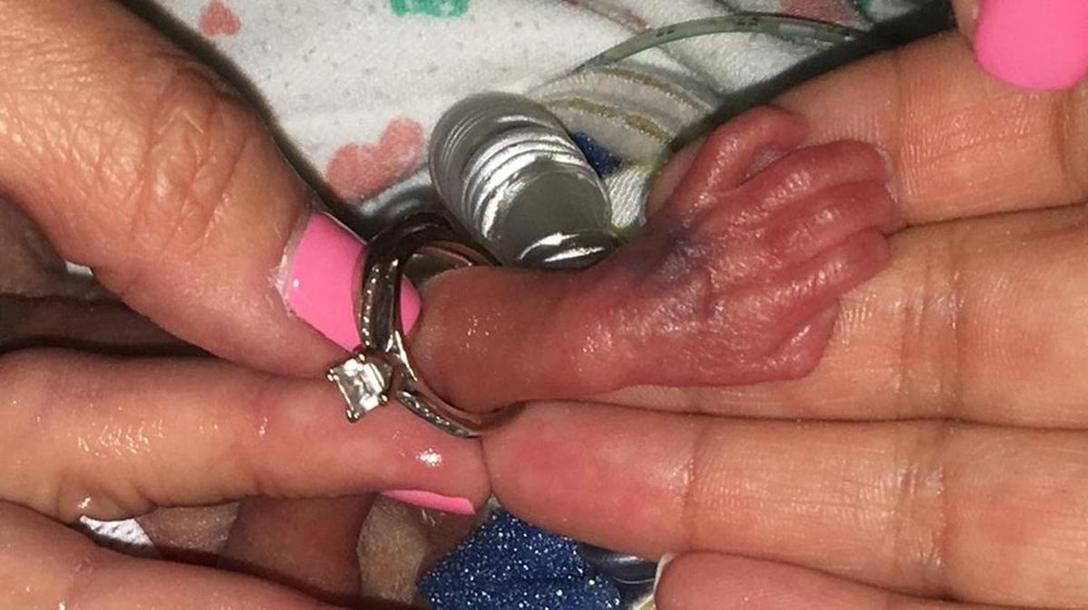 La mano de Lailie Victoria, una bebé de casi cuatro meses y medio que pesó al nacer solo 13 onzas (poco más de 368 gramos).