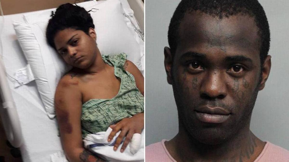 Cynthia Cortés en el hospital y la foto de arresto de Yosvanis Sierra, más conocido como ‘Chocolate’. 