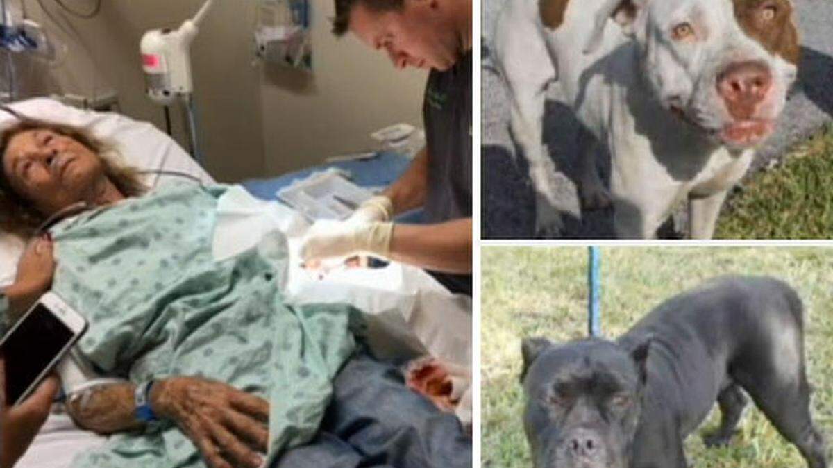 Ada Rojas, de 83 años, paseaba a su Chihuahua Gucci, como todas las mañanas, cuando dos perros de la raza Bulldog americano se lanzaron al ataque. Cortesía NBC6.