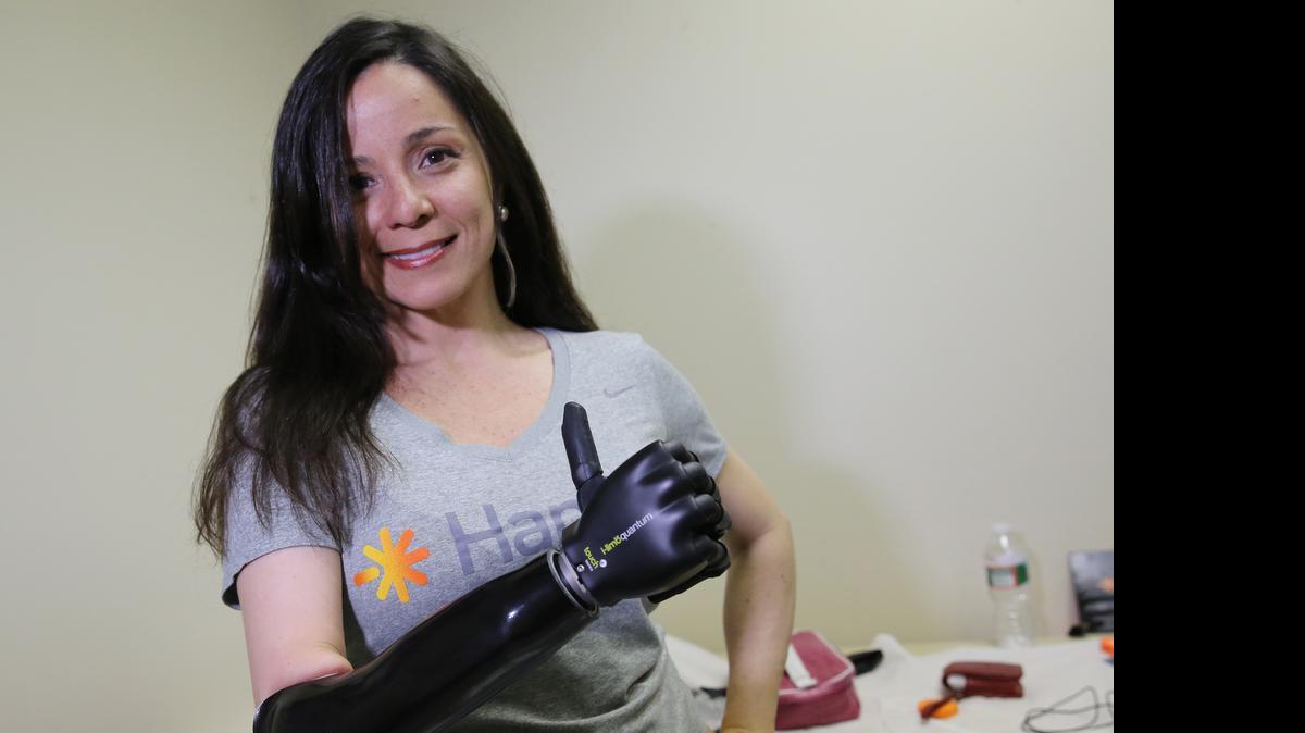 
Lizbeth Uzcategui demostró la facilidad de su nueva prótesis, un delgado antebrazo negro y una mano con dedos de goma que le permiten una completa movilidad en toda su mano. Su palma se abre y luego se cierra mientras forma una señal con el pulgar hacia arriba.


